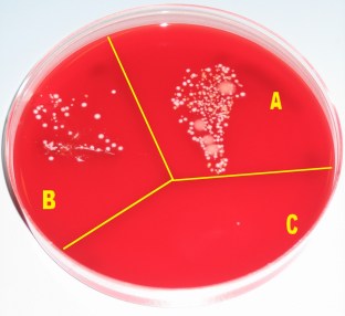 W1-Wikipedia-figure-Hand_desinfection_test_with_blood_agar_plate.jpg